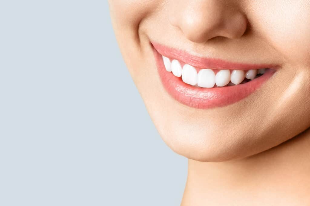 Teeth Whitening in Nashville: Weighing the Pros and Cons
